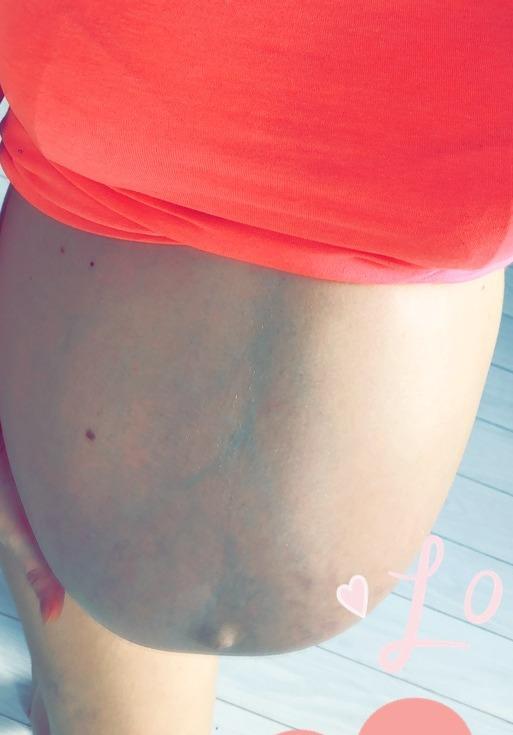 Big Belly Love — fotos e vídeos +18