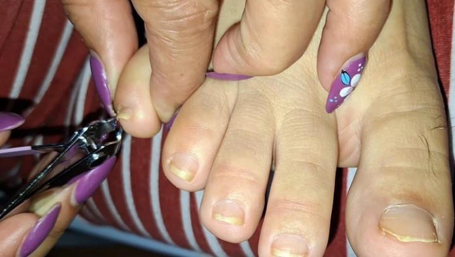 My Toenails