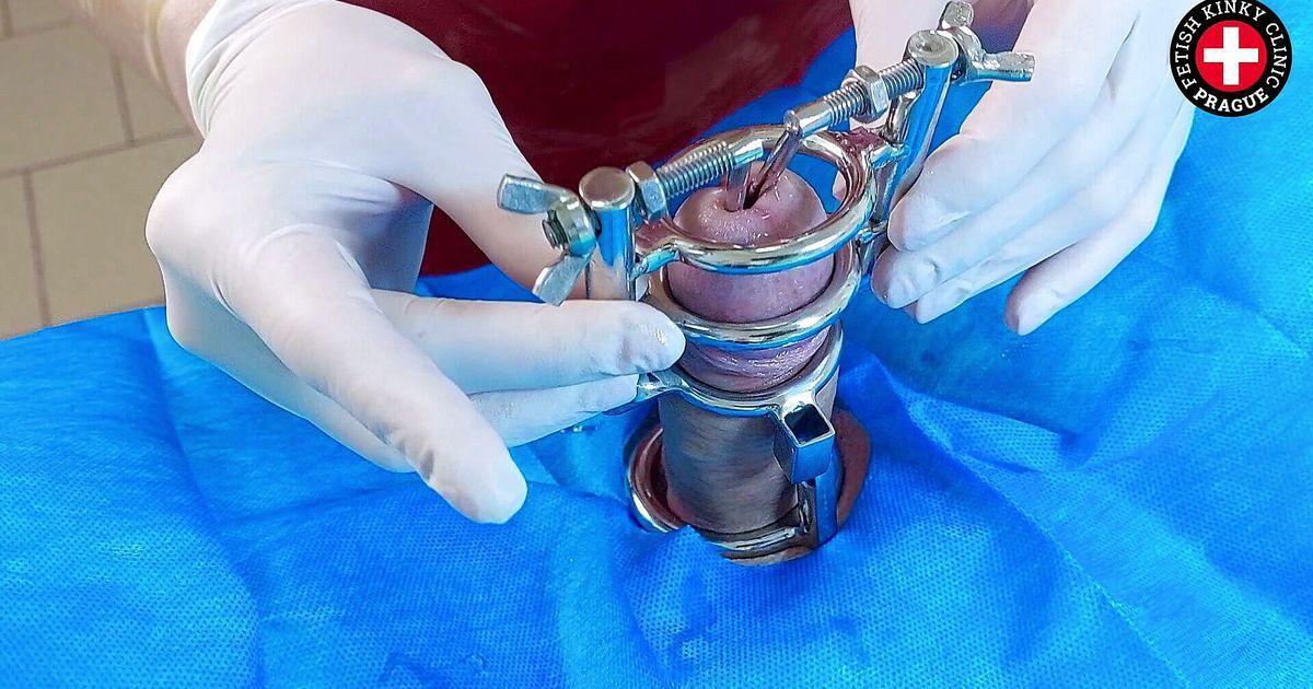 Urethral Stretching