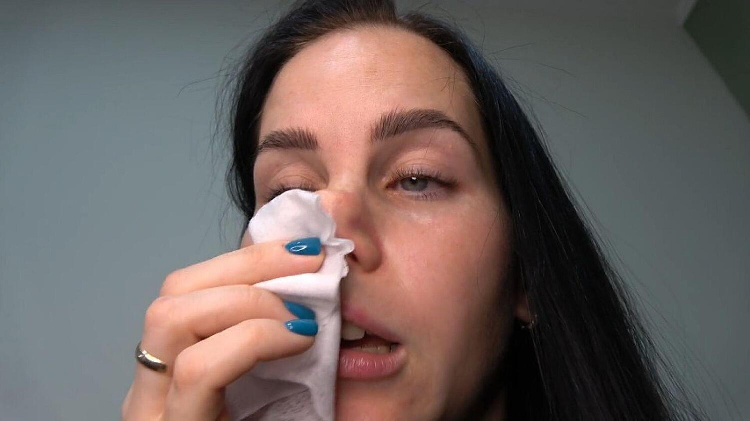 Anna Sneezes And Blows Her Nose With A Pig Nose