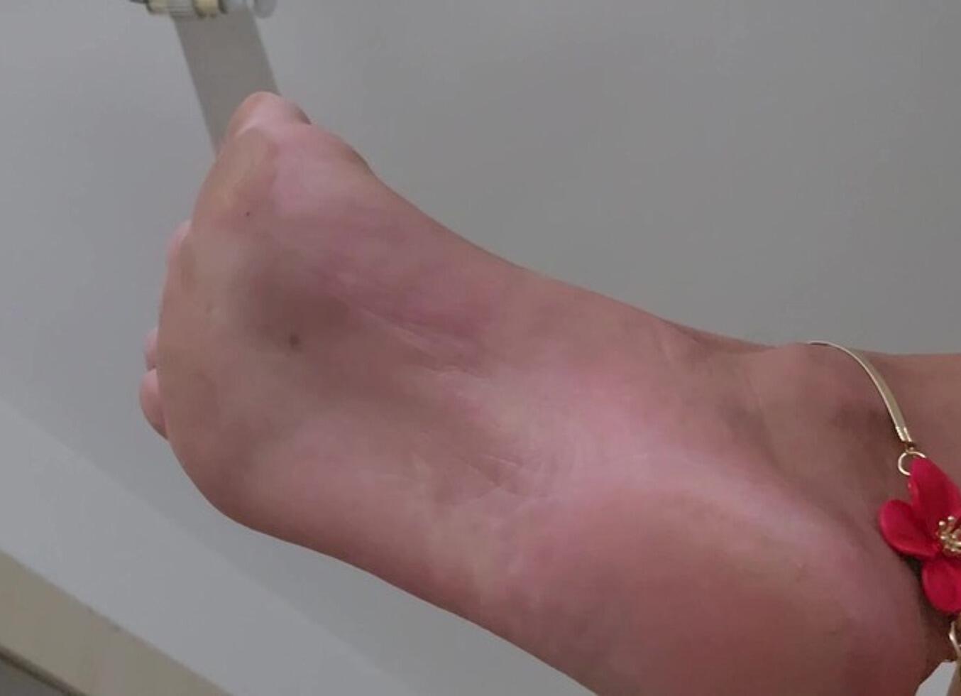 Foot And Ankle * Bracelets