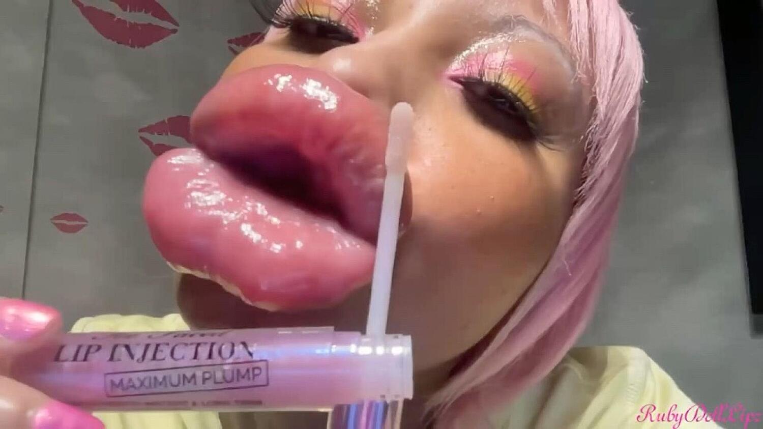 2/3/26 Growing 5Xl Lips