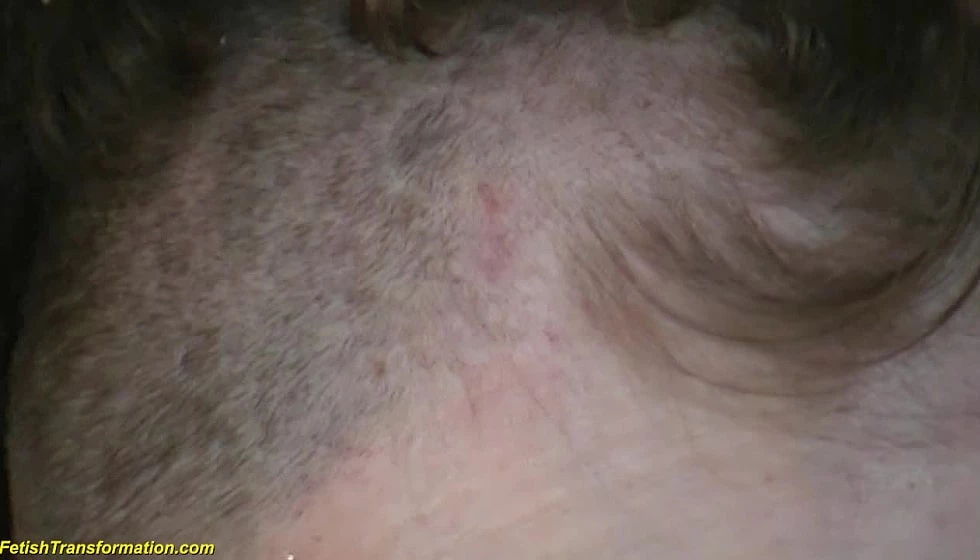 Loosing Hair
